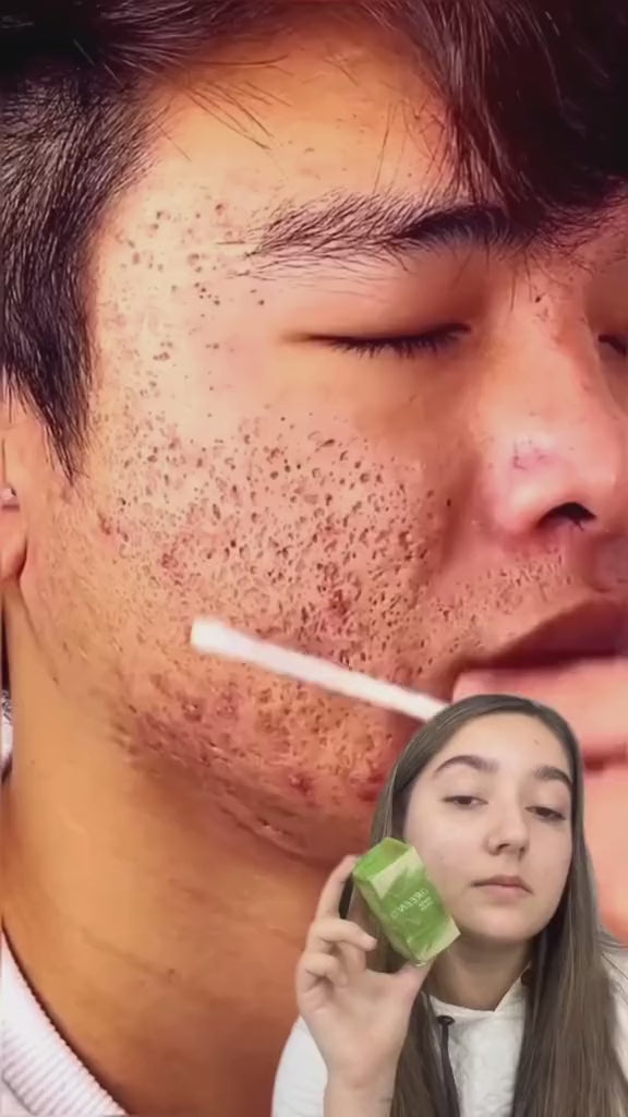 Mascarilla Facial de Té Verde Limpieza Profunda y Control de Grasa